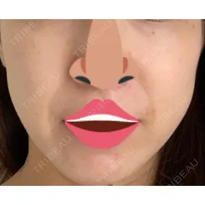 湘南美容クリニック 湘南美容クリニック 名古屋栄院口コミ