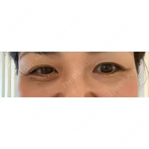 TCB東京中央美容外科 TCB東京中央美容外科 中野院口コミ