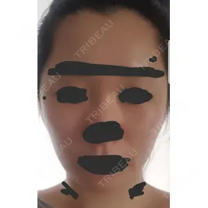 ボンディ美容整形外科（旧リオン整形外科）口コミ