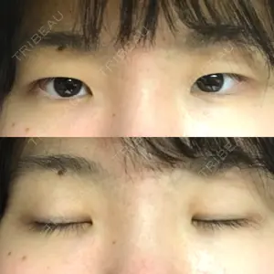 TCB東京中央美容外科 TCB東京中央美容外科 中野院口コミ