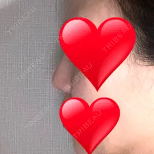 リッツ美容外科 大阪院口コミ