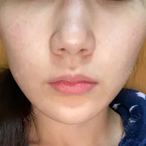 湘南美容クリニック 湘南美容クリニック 柏院口コミ