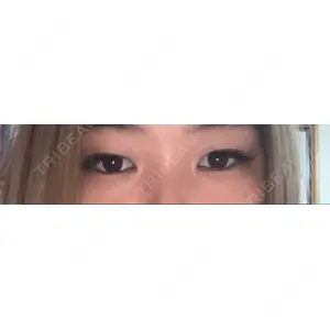 id美容外科の口コミ