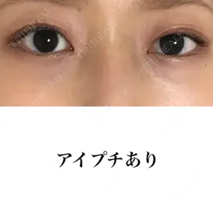 A CLINIC（エークリニック） A CLINIC（エークリニック） 銀座院口コミ
