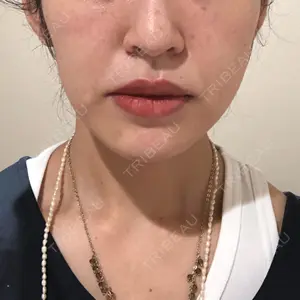 口コミ