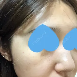南青山TOKUNAKAクリニック口コミ