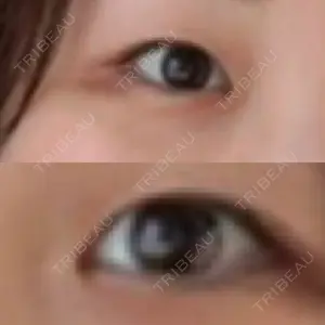 いちのせ形成外科・皮膚科 眼瞼＆フェイスクリニック口コミ