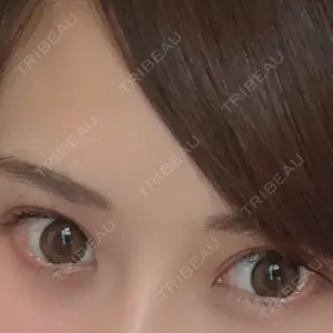 TCB東京中央美容外科 TCB東京中央美容外科 中野院口コミ