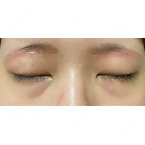 品川美容外科 品川スキンクリニック札幌院	（品川美容外科 札幌院と統合）口コミ