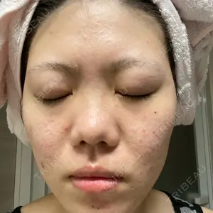 VENUS BEAUTY CLINIC　銀座院口コミ