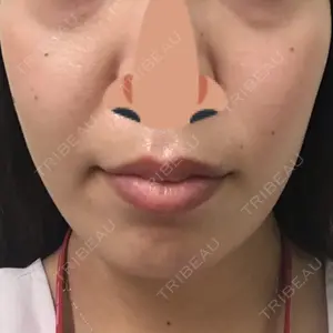 SUEクリニック口コミ