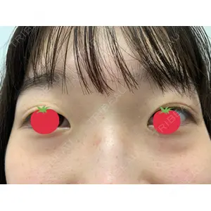 TCB東京中央美容外科 TCB東京中央美容外科 中野院口コミ
