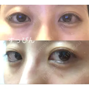 口コミ