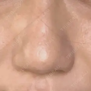銀座ゼロクリニック口コミ