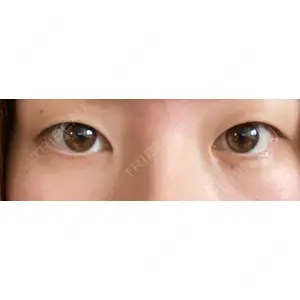 湘南美容クリニック 湘南美容クリニック 宇都宮院口コミ