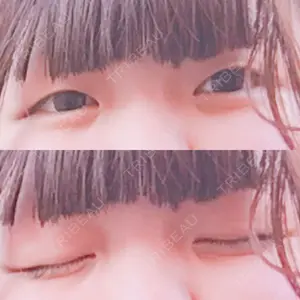 湘南美容クリニック 湘南美容クリニック 池袋東口院口コミ