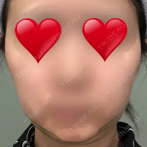くさのたろうクリニック口コミ