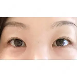 口コミ