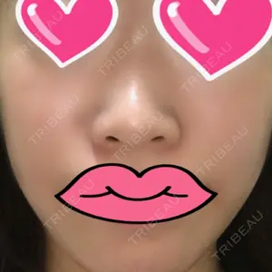HANABI整形外科口コミ