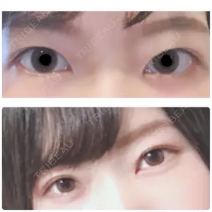 松下皮フ形成外科口コミ