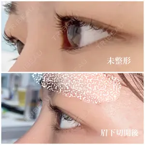 口コミ
