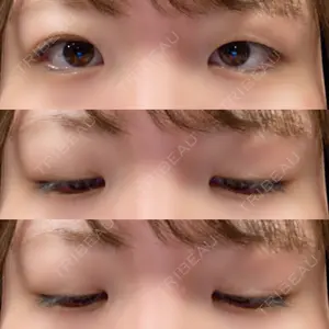 東京イセアクリニック口コミ