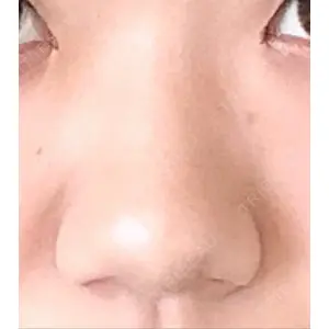 グロービー美容整形外科口コミ