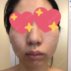 湘南美容クリニック 湘南美容クリニック 新宿本院口コミ