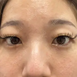 TCB東京中央美容外科 TCB東京中央美容外科 梅田茶屋町院口コミ