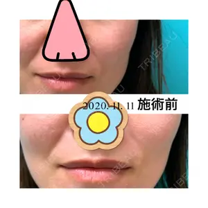 口コミ