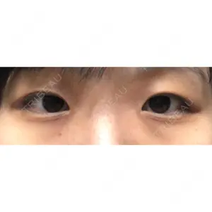 東京BELLEZZAクリニック口コミ