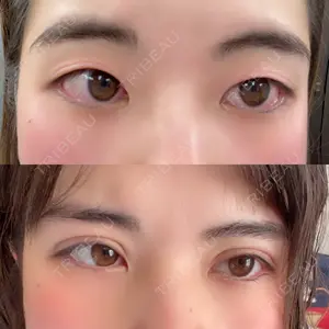 TCB東京中央美容外科 TCB東京中央美容外科 町田院口コミ