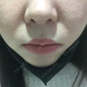 口コミ