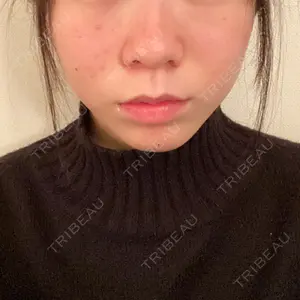 口コミ
