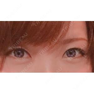 プリモ麻布十番クリニック口コミ