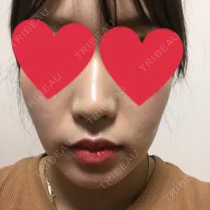 Zetith Beauty Clinic 銀座院口コミ