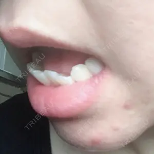 口コミ