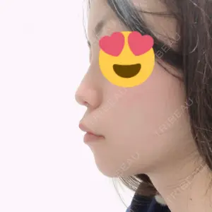 口コミ