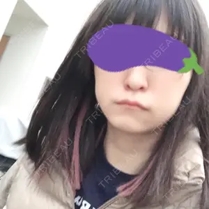 TCB東京中央美容外科 TCB東京中央美容外科 渋谷東口院口コミ