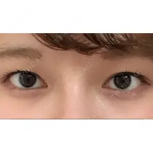 グロービー美容整形外科口コミ