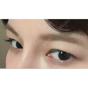 グロービー美容整形外科口コミ