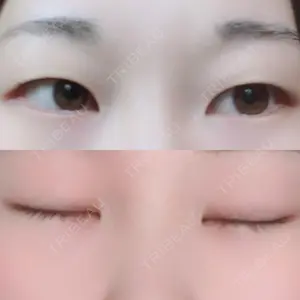 湘南美容クリニック 湘南美容クリニック 小倉院口コミ