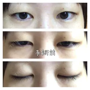 いちのせ形成外科・皮膚科 眼瞼＆フェイスクリニック口コミ