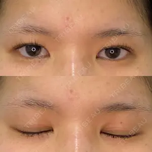 東京BELLEZZAクリニック口コミ
