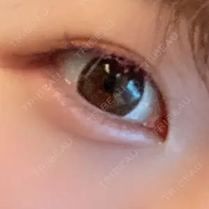 松下皮フ形成外科口コミ