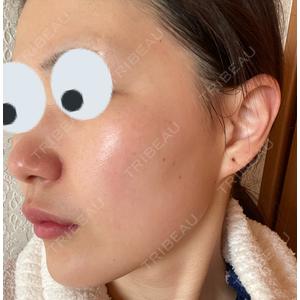 湘南美容クリニック 湘南美容クリニック 柏院口コミ