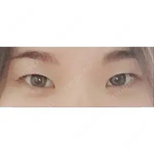 口コミ