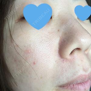 B-LINE CLINIC B-LINE CLINIC 池袋院口コミ