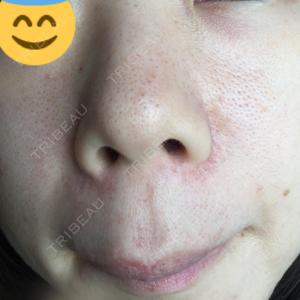 B-LINE CLINIC B-LINE CLINIC 池袋院口コミ