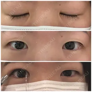 東京イセアクリニック口コミ